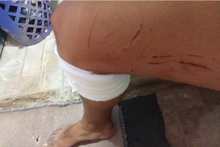 Violento ataque en San Jaime de la Frontera: un hombre perseguido y agredido Violento ataque en San Jaime de la Frontera: un hombre perseguido y agredido